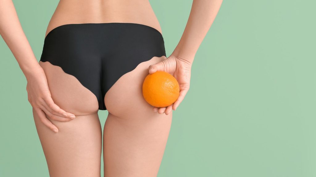 Qu'est ce que la cellulite?